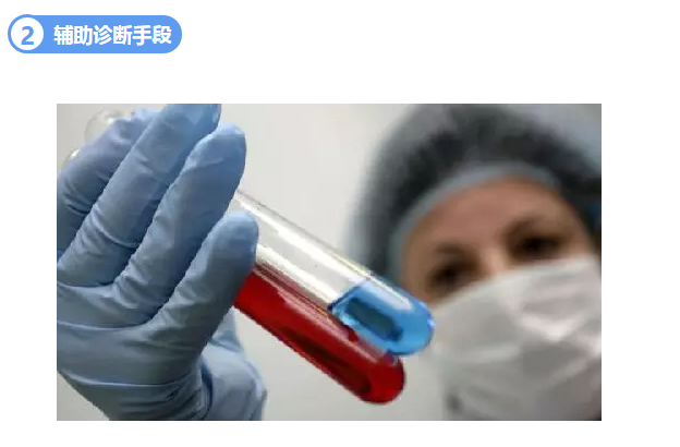 甜性涩爱迅雷下载