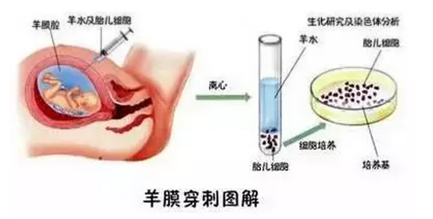 甜性涩爱迅雷下载