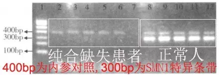 甜性涩爱迅雷下载