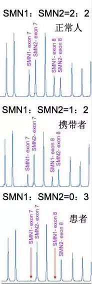 甜性涩爱迅雷下载