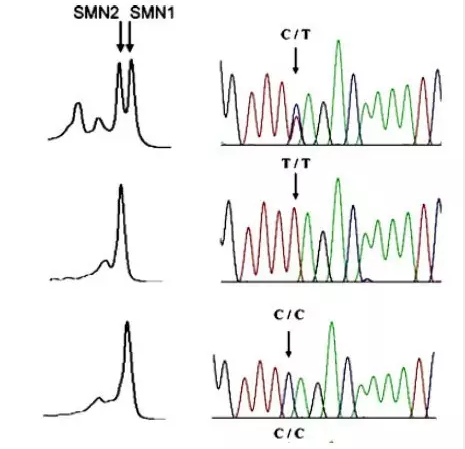 甜性涩爱迅雷下载