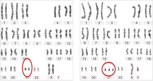 甜性涩爱迅雷下载