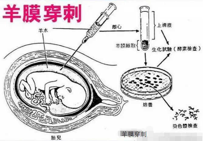 甜性涩爱迅雷下载