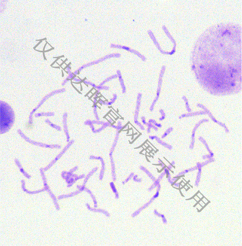 甜性涩爱迅雷下载