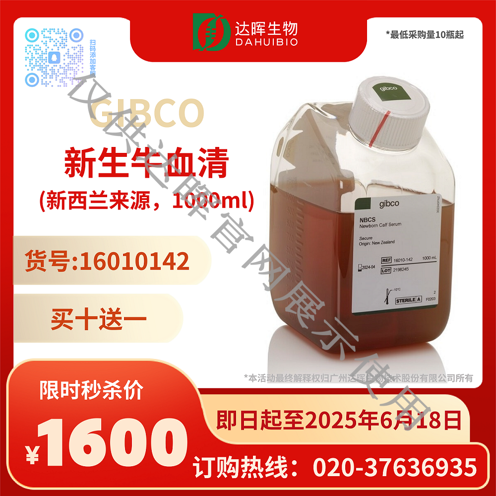 甜性涩爱迅雷下载